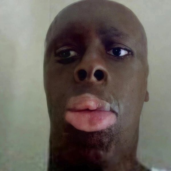 Лысый нигер