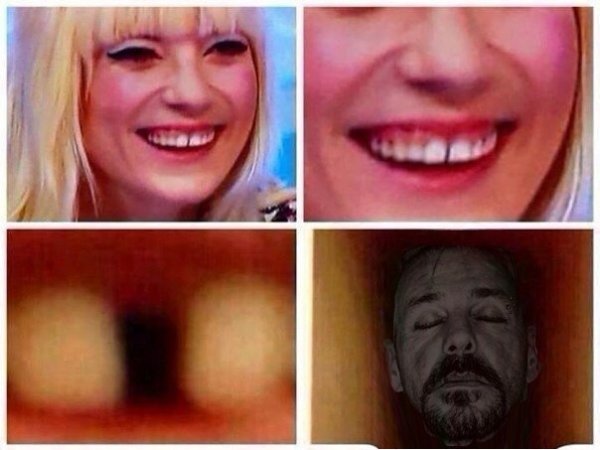 Негр между зубов