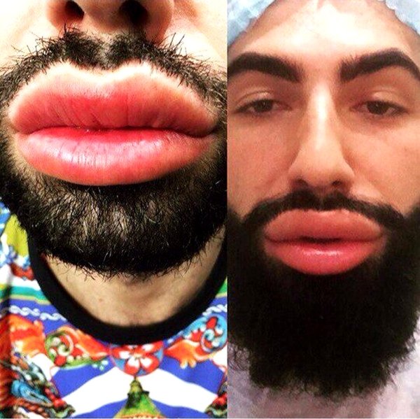 Араик блоггер