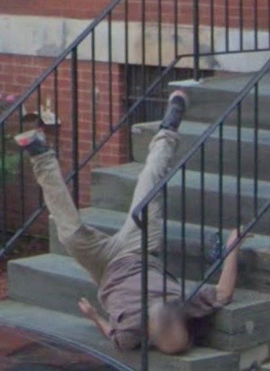 Человек упавший с лестницы