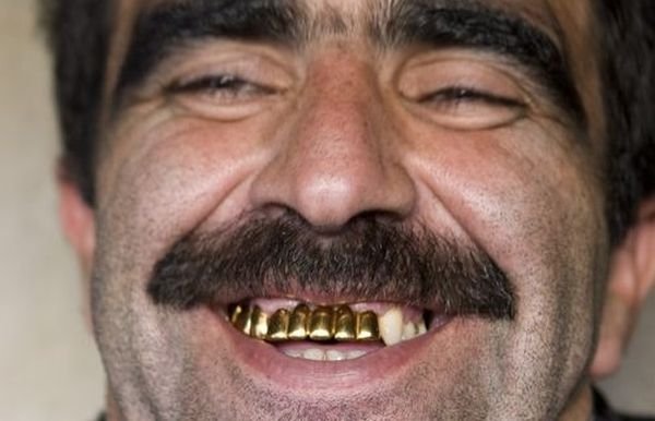 Цвганис золотыми зубами