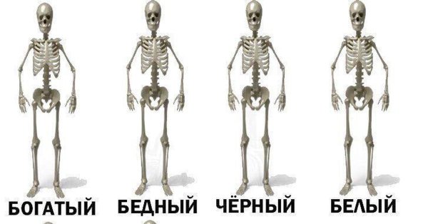 Скелет бедного, богатого