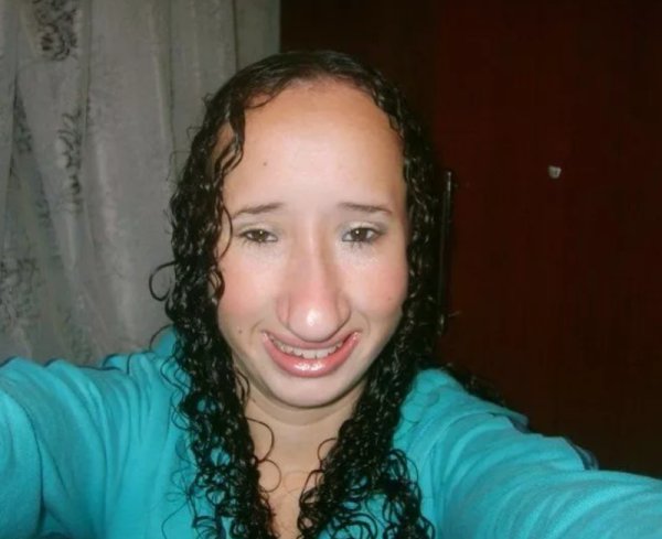 Огроменный нос у девушки