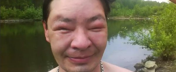 Алкащь с опухшими глазами