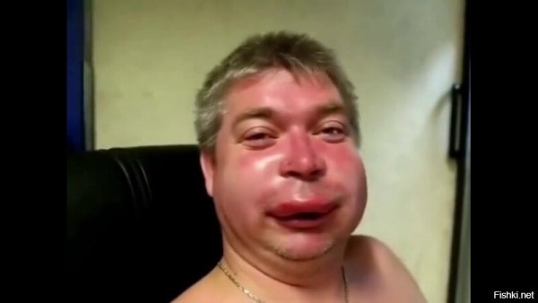 Отцо покусаное пчелами