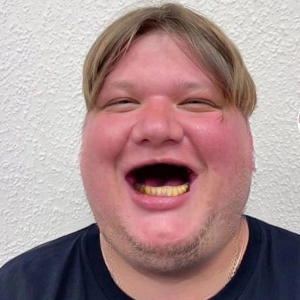 S1mple 2023 толстый