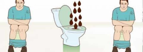 Понос рисунок