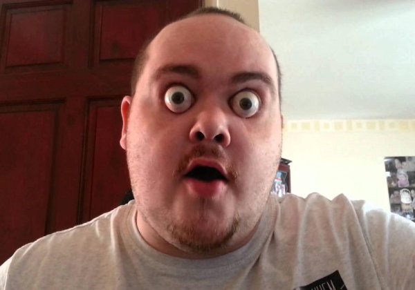 Парень свыпучеными глазами