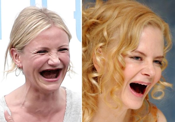 Кэмерон Диаз Беззуба беззубая