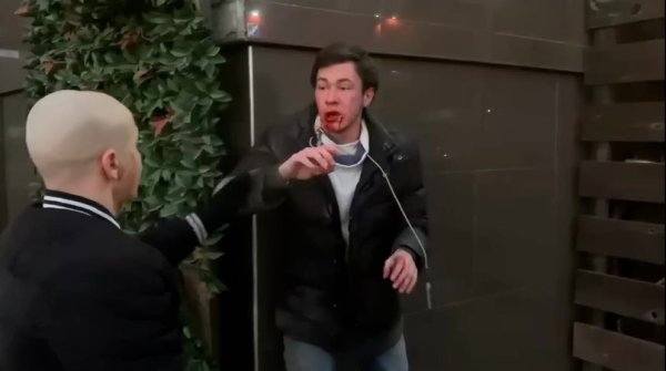 Моего парня избили