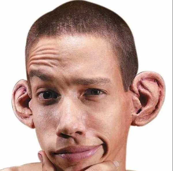 Человекьс большими ушами