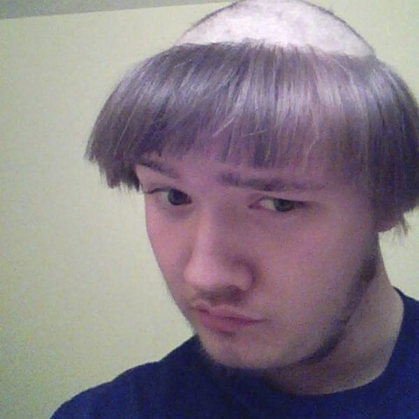 Лысина с челкой