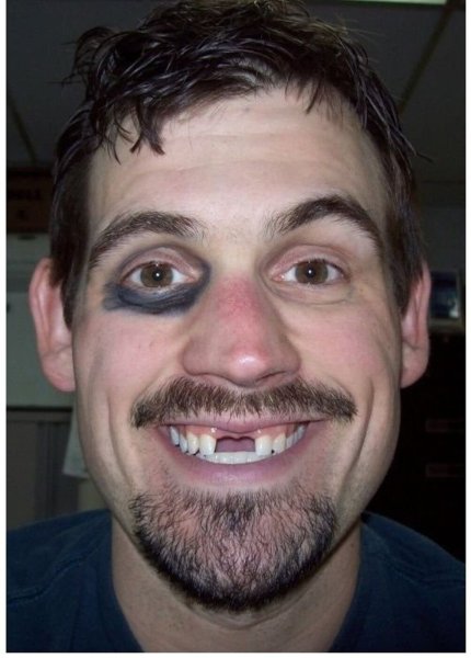 Чел без передних зубов