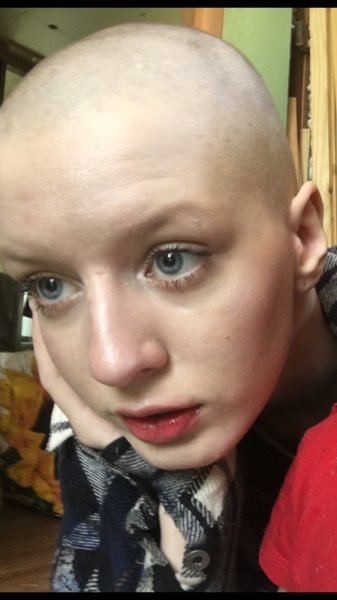 Пацанки лысая девчонка