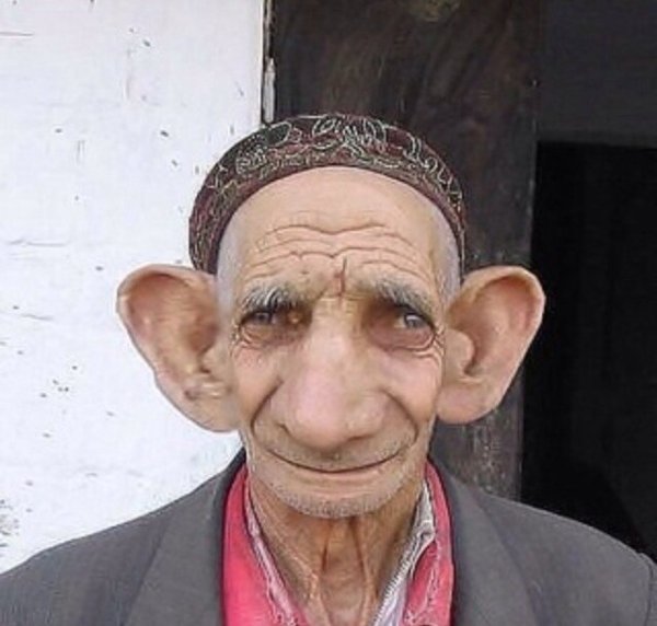 Человек с самыми большими ушами