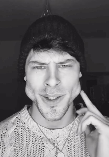 Скулы у парней