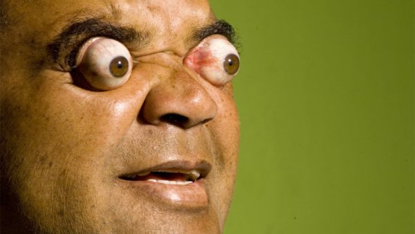 Клаудио Пинто вытаращивает глаза