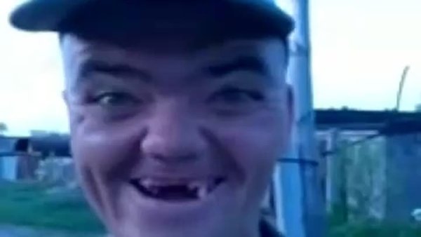 Беззубый мужик смеется