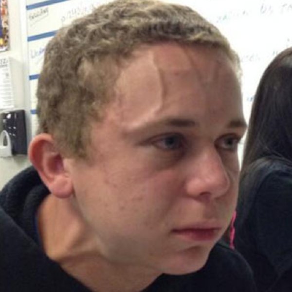 Чел напряженный с Веной на лбу