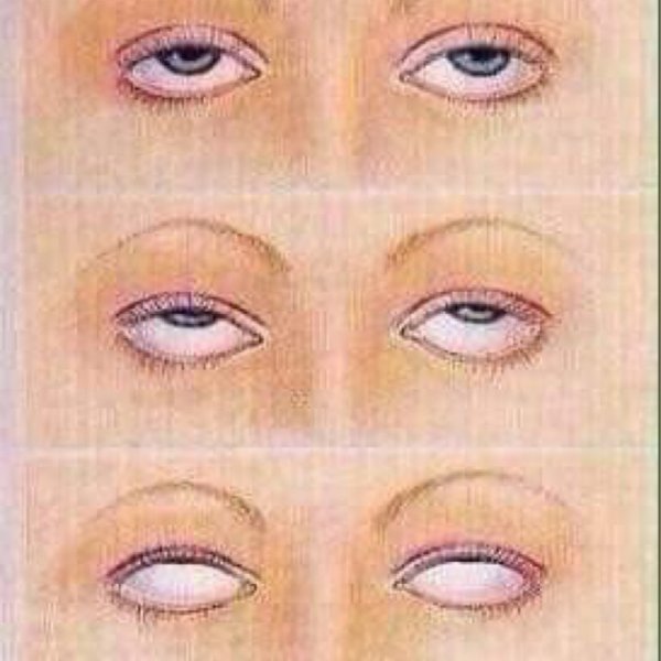 Закатывание глаз картинка