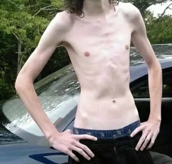 Худой парень