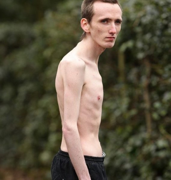 Худой парень