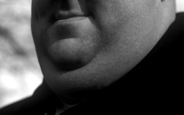 Двойной подбородок