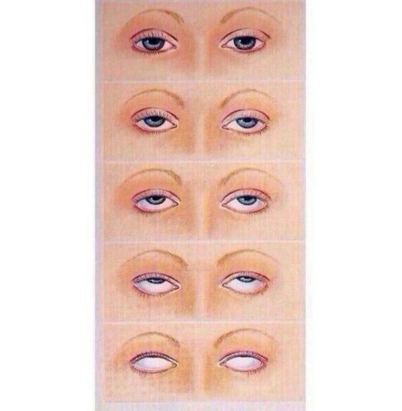 Зрачки закатываются вверх