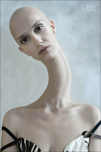 Лысая девочка