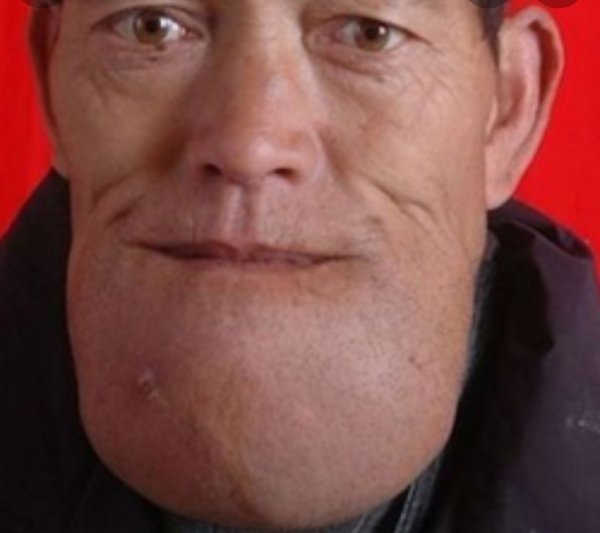 Люди с большим подбородком