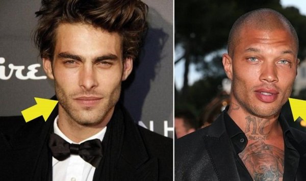 Массивная челюсть у мужчин