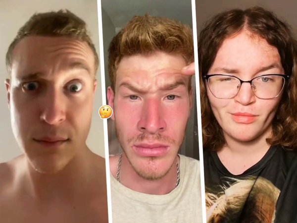 Покраснение на скулах у мужчин