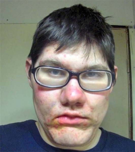 Уродливые парни в очках