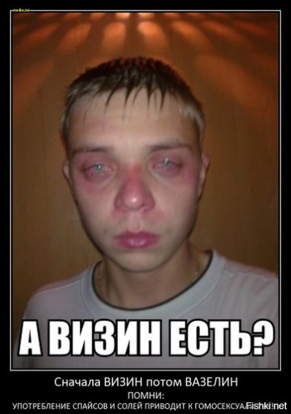 Красные глаза наркомана