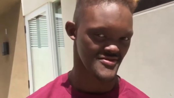 Мужик с челюстью