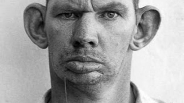 Человек с большими ушами