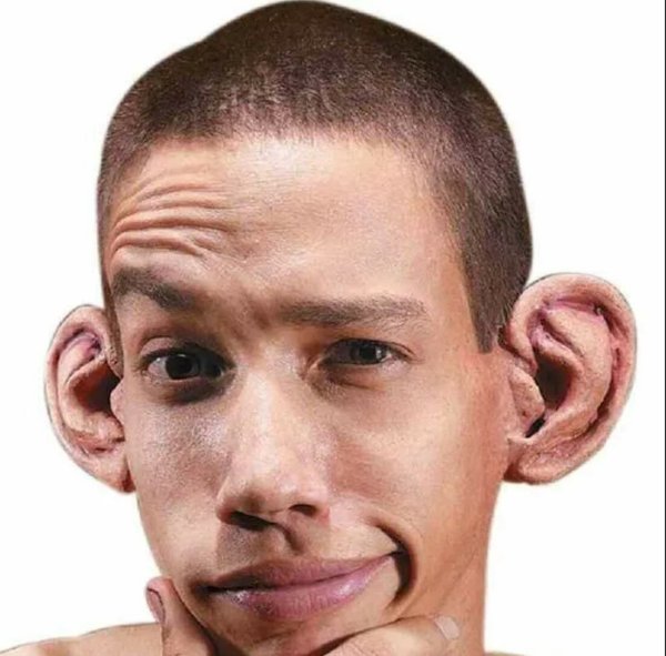 Человекьс большими ушами