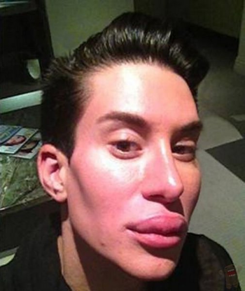 Пареньснакачеными губами