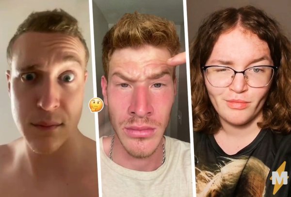 Сделать скулы парню