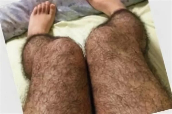 Очень волосатые женские ноги