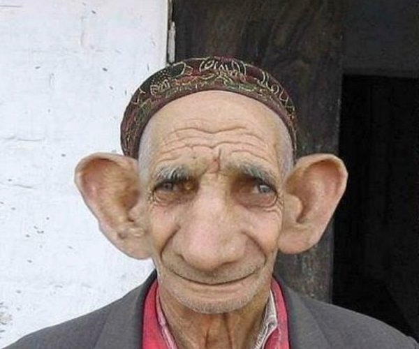 Сергей Мальченко самые большие уши