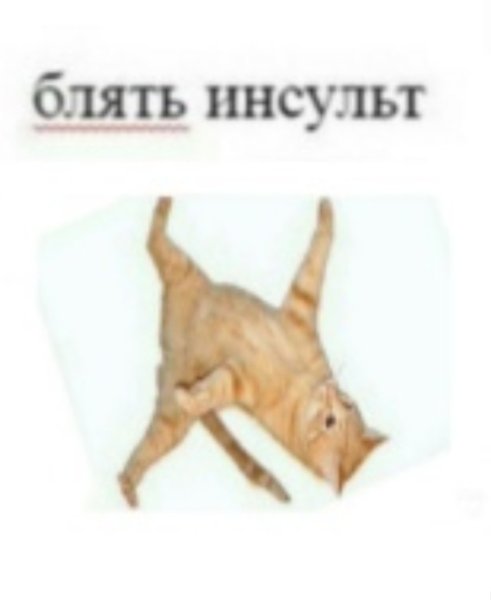 Инсульт с мужиком