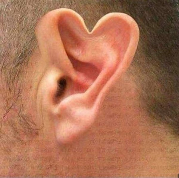 Перихондрит ушной раковины