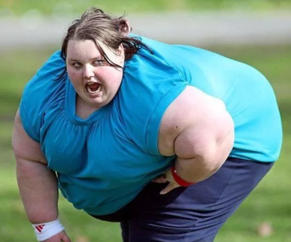 Ожирение у девушек