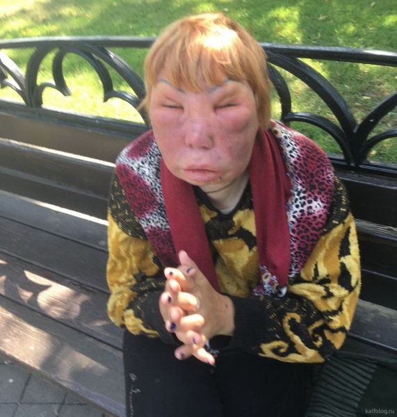 Адкащка с опухшими глазами