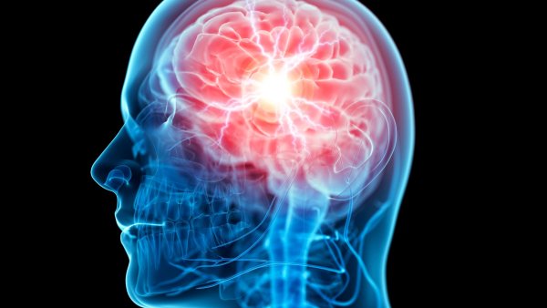 Светящийся мозг