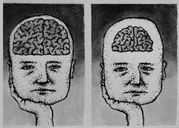 Маленький мозг