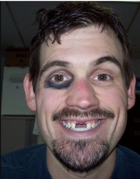 Чел без передних зубов