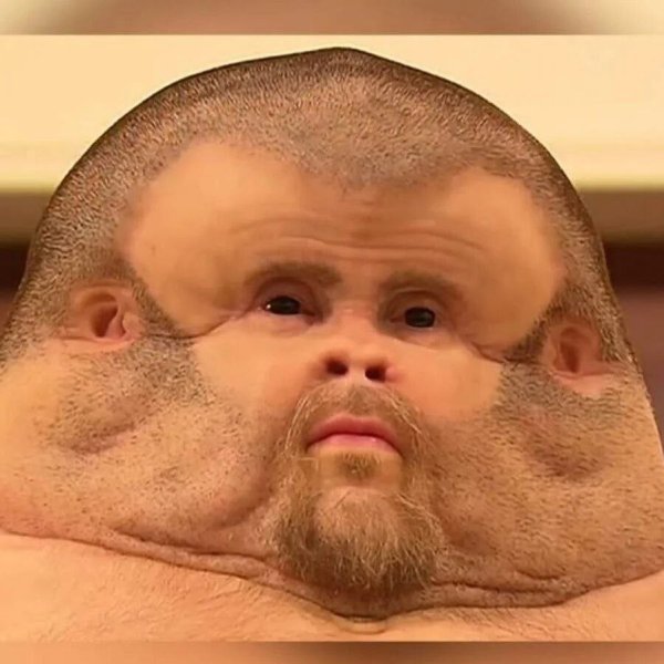 Толстое лицо