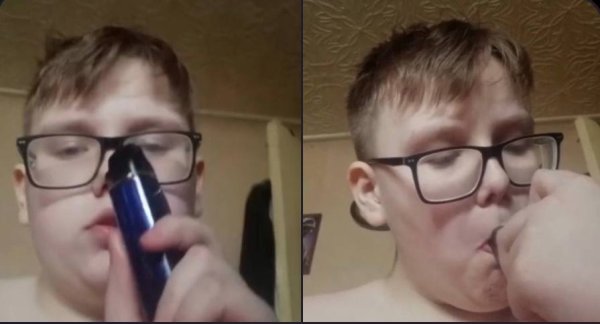 Взорвалась электронная сигарета